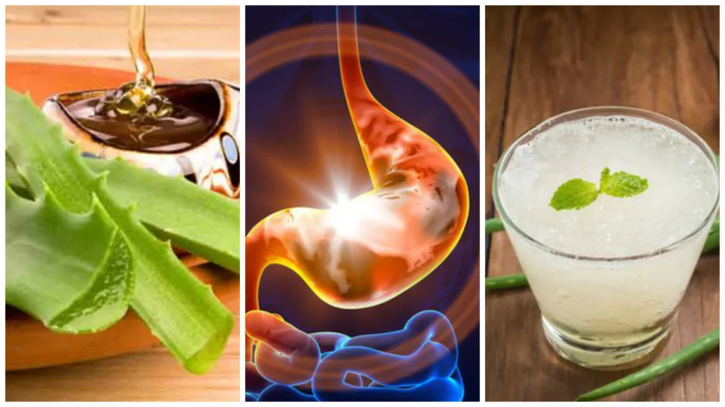 Cómo aliviar la gastritis con remedios caseros